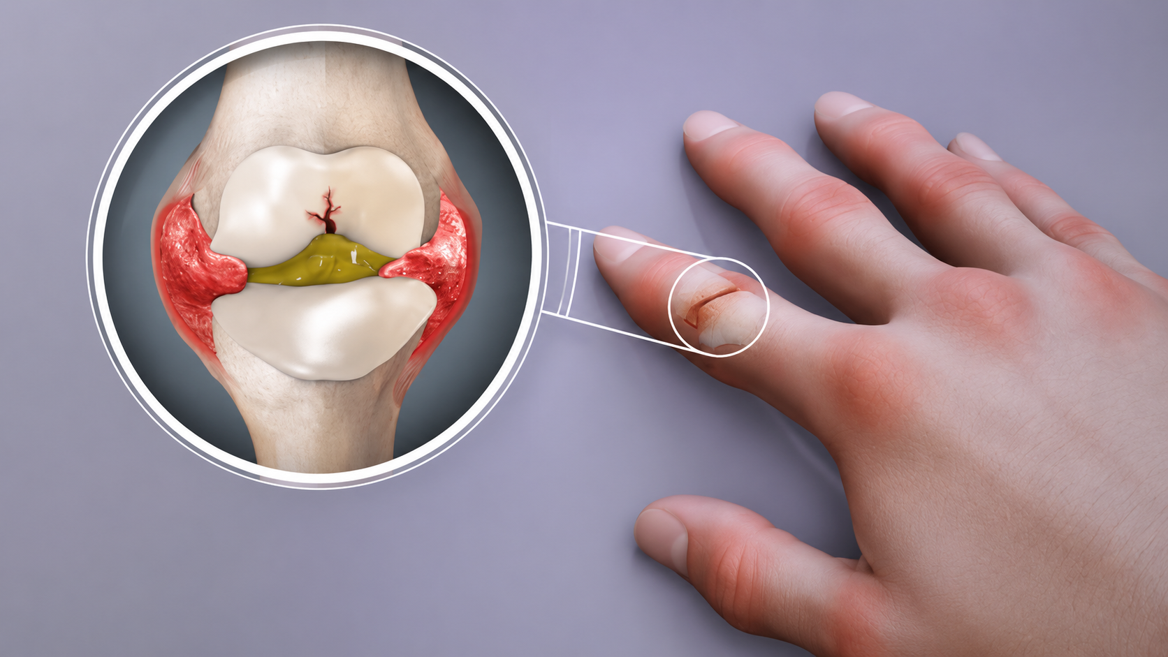 Bienestar articular y movilidad